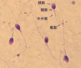 正常形態精子