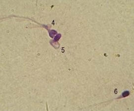 奇形精子2